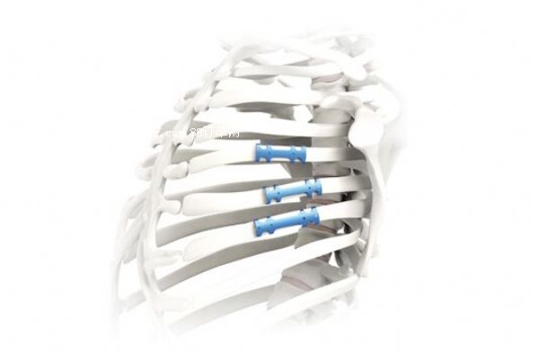 �N���߹ǰ� �߹ǰ�S�ҏV�|��r